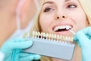 porcelain veneers benefits Gaithersburg Maryland